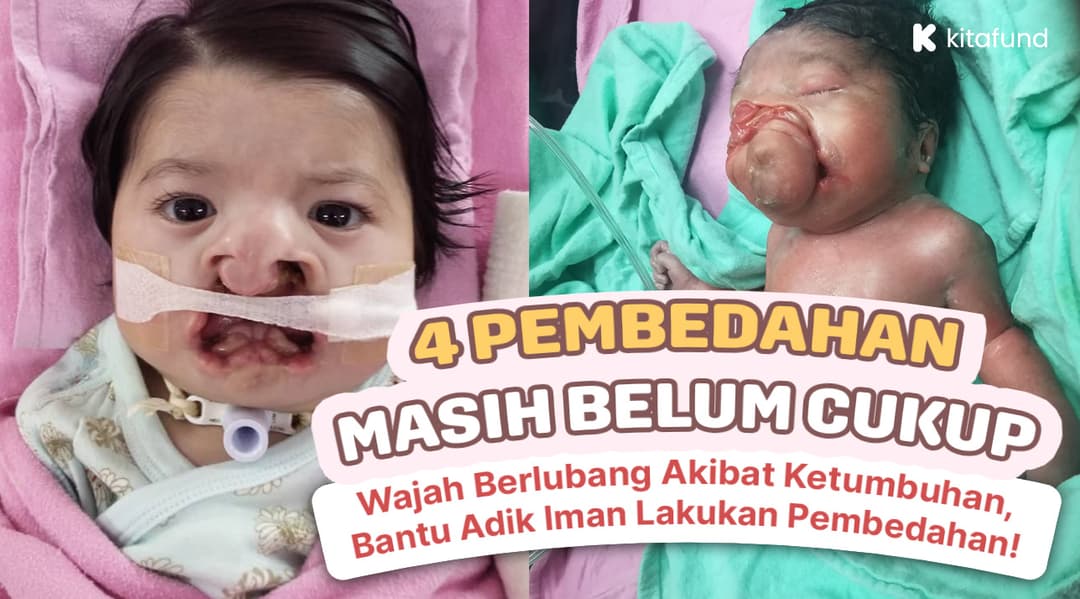 BANTU TAMATKAN DERITA ADIK IMAN!