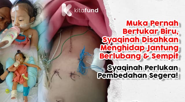 Tolong Kos Pembedahan Jantung adik Nur Syaqinah Adawiyah