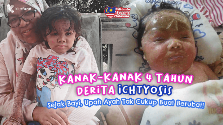 Kisah Aisyah Humairah, Diikat dengan Ujian Sejak Lahir!