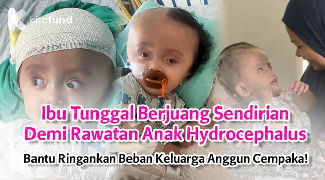 Bantu Anggun, 2 Tahun, Teruskan Rawatan & Terapi Untuk Membesar Dengan Lebih Selesa
