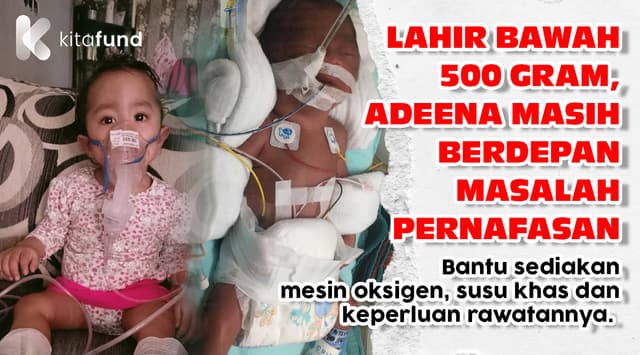 URGENT! Nafas Adeena Masih Turun Naik, Kos Rawatan Makin Tinggi — Mohon Bantuan Segera