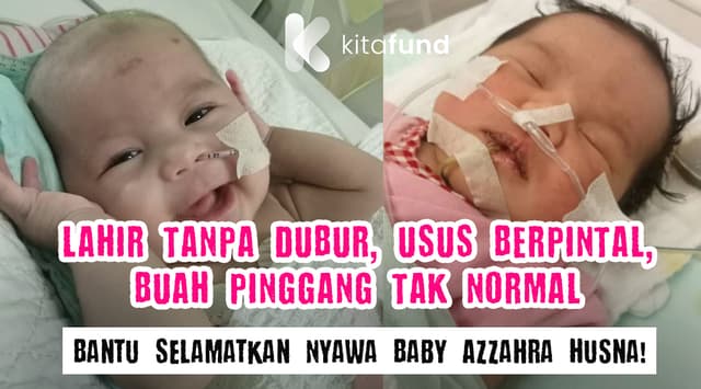 URGENT! Nyawa Baby Azzahra Husna Dalam Bahaya Tanpa Rawatan Segera!