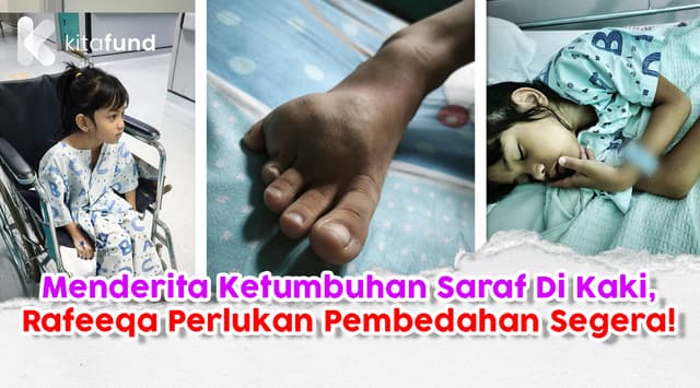 Ketumbuhan Saraf Di Kaki Membengkak, Bantu Rafeeqa Dapatkan Rawatan!