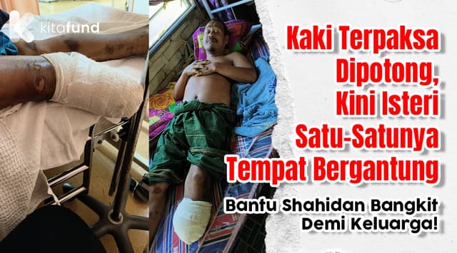 Tak Mampu Lagi Bekerja Selepas Kehilangan Kaki, Rayuan Buat Encik Shahidan & Isteri