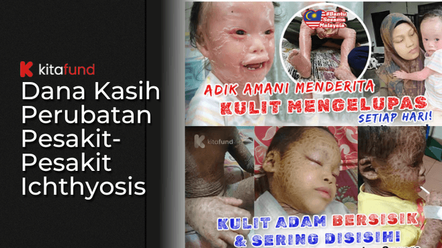 Dana Kasih Perubatan Pesakit-Pesakit Ichthyosis
